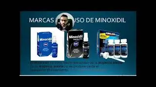MINOXIDIL USOS ALOPECIA Y BARBA