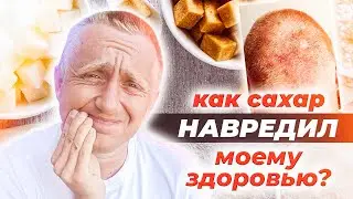 К чему приводит злоупотребление сладким и как избавиться от зависимости. Мой опыт.