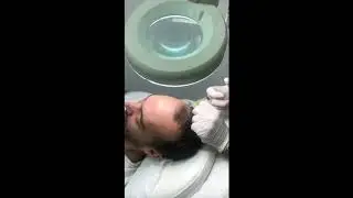 Plasma Rico en Plaquetas Capilar. Clínica Merced 👩‍⚕️👨‍⚕️