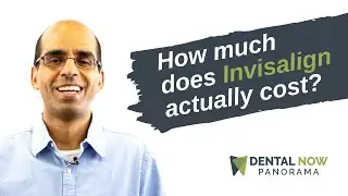 What is the Price of Invisalign in 2021?