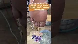 Can your toes do this?? They can with a needle and some electricity! 