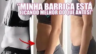 Como minha Barriga voltou depois de 2 anos da minha gestação?
