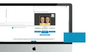 SmileView Setup Guide