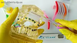 Уход за полостью рта