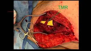 TMR Netherlands Society Plastic Surgery