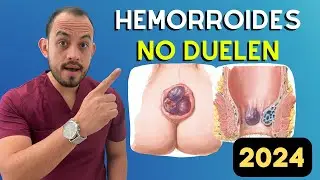 ☢️ ¡Esto Debes Saber sobre 𝗛𝗘𝗠𝗢𝗥𝗥𝗢𝗜𝗗𝗘𝗦! 𝐂𝐚𝐮𝐬𝐚𝐬, 𝐒𝐢́𝐧𝐭𝐨𝐦𝐚𝐬 𝐲 𝐓𝐫𝐚𝐭𝐚𝐦𝐢𝐞𝐧𝐭𝐨