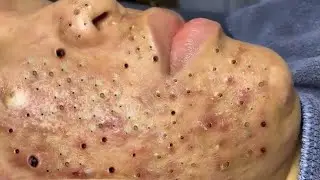𝐄𝐧𝐣𝐨𝐲 𝐭𝐡𝐞 𝐬𝐮𝐫𝐩𝐫𝐢𝐬𝐞 𝐟𝐫𝐨𝐦 𝐋𝐨𝐚𝐧𝐍𝐠𝐮𝐲𝐞𝐧 