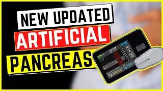 NEW ARTIFICIAL PANCREASE FOR TYPE 2 DIABETES | ALTERNATIVE TO AN INSULIN INJECTION| ENGLISH