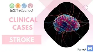 Stroke Clinical Case