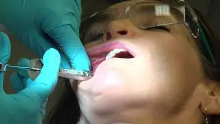 Dental Hygiene Local Anesthesia 2011
