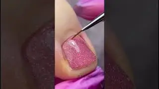 Трещина ногтя 