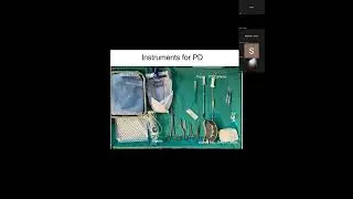 Peritoneal Dialysis in neonatal AKI Dr Preeti Solanki