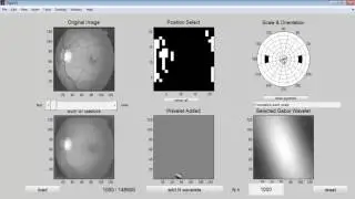 2D Gabor Wavelet Vascular Pattern Matlab Projects