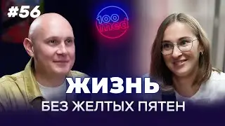 Гипергидроз | Почему Вы Чрезмерно Потеете? | Лечение, Которое Вернет Уверенность