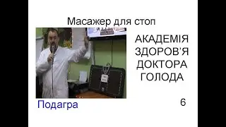 Подагра – презентація доктора Голода