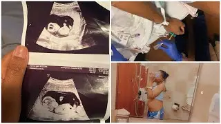SICKLE CELL AND PREGNANCY VLOG !