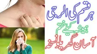 Naak Ki Alerji Ka Alaj|ناک کی آلرجی کا  علاج| Health Tips by Ghaffar