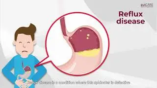 Gastroesophageal Disease (#GERD) 101 | GUTCARE