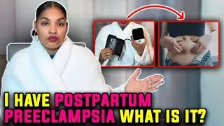 I Have Postpartum Preeclampsia! What is it? Symptoms & More 😢