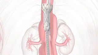 TAMBE Product Animation