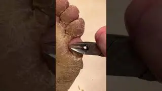 #skincare #skincareroutine #fyp #fypシ゚viral #footcare #viralshorts #viralvideos #omg