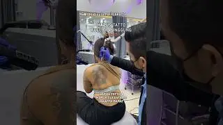 HAPUS TATTO DI PUNGGUNG‼️ TATTO NYA BESAR BANGET 