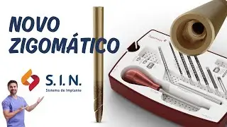 Novo Implante Zigomático SIN - Zygomatic Plus