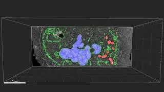 Automated image segmentation using CATS: EM mitotic HeLa cell