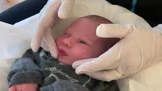 Exercices pour le frein de langue restrictif avant et après freinotomie chez un bébé