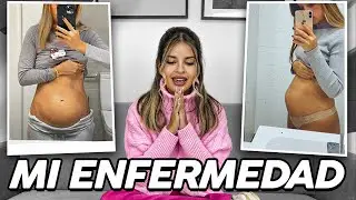 MI ENFERMEDAD... Natalia Osona