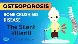 Shocking Truth About Osteoporosis - The Bone breaking disease you might have !!!