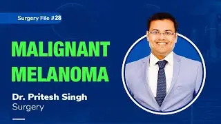 Topic | Malignant Melanoma I Dr. Pritesh SIngh | Surgery