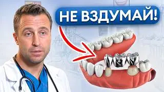 Эти коронки УБИВАЮТ здоровые зубы! / Как правильно выбрать зубные коронки
