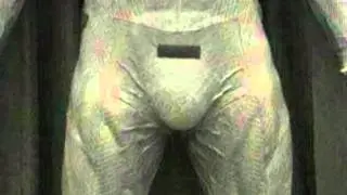 Epic BatSack!