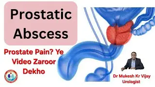 Prostate Abscess Kya Hota Hai? Causes, Signs & Latest Treatment 😱 Prostate Infection Ka dangerous 😳 