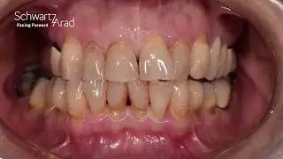 Horizontal and Vertical Defects part 2 of 2