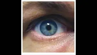 Circle - Blue King