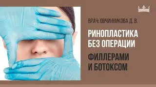 Ринопластика без операции филлерами и ботоксом
