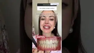 Respondo a tus PREGUNTAS SOBRE IMPRESS | Ortodoncia Invisible Impress