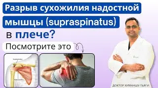 Разрыв сухожилия надостной мышцы (supraspinatus) в плече? Посмотрите это.