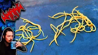 The Reddit Pinworm Buttplug - Tales From the Internet