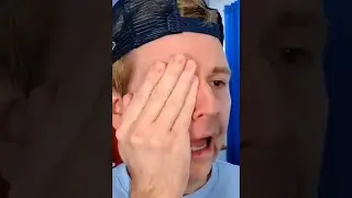 EYEBALL JOKE GONE WRONG! 