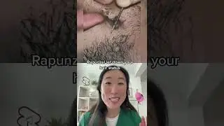 The most massive ingrown hair cyst! The only way to get rid of this is extraction