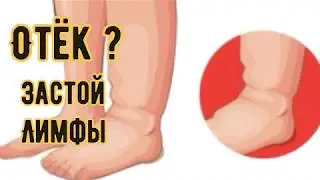 Как почистить лимфу в домашних условиях? Выводим токсины , яды и шлаки..