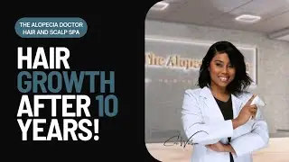 10 Years of Hair Loss Reversed: Watch This Amazing Transformation!
