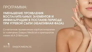 Программа: 