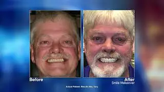 Extreme Smile Makeovers with Houston, TX dentist Sridhar Sista, DDS