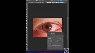 fix red bloodshot eyes in seconds 