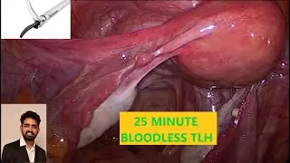 FAST BLOOD LESS TLH USING 2 SECONDARY PORTS ONLY
