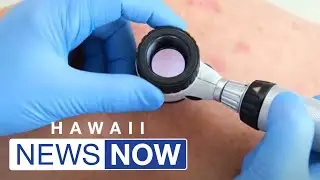 Honolulu firefighters undergo free cancer screenings